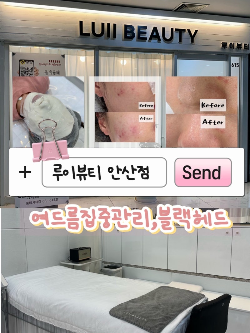 안산 중앙역 피부관리 루이뷰티｜화농성 여드름 압출·살균·앰플·진정까지 받은 여드름집....