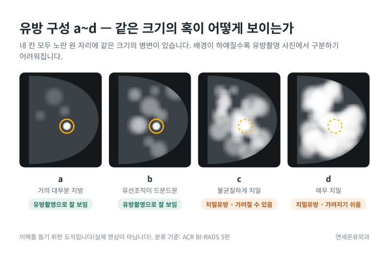 [인천 유방외과] 치밀유방이라고 나왔다면, 유방초음파를 꼭 같이 보셔야 하는 이유
