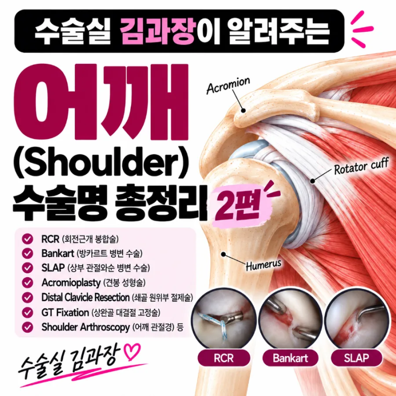 어깨(Shoulder)수술명 의학용어 총정리 ②편｜회전근개봉합술 어깨관절경 석회제거술 해부학 ....
