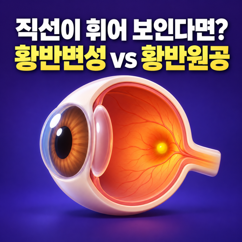 황반변성과 황반원공 차이, 직선 휠 때 꼭 확인할 관리법