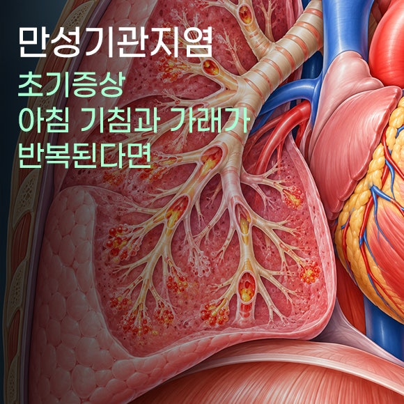 만성기관지염 초기증상, 아침 기침과 가래가 반복된다면
