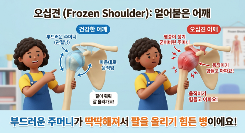 오십견