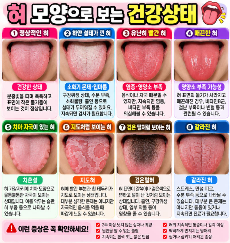 혀를 보면 건강이 보인다? 혀 모양·색깔로 알아보는 몸의 신호