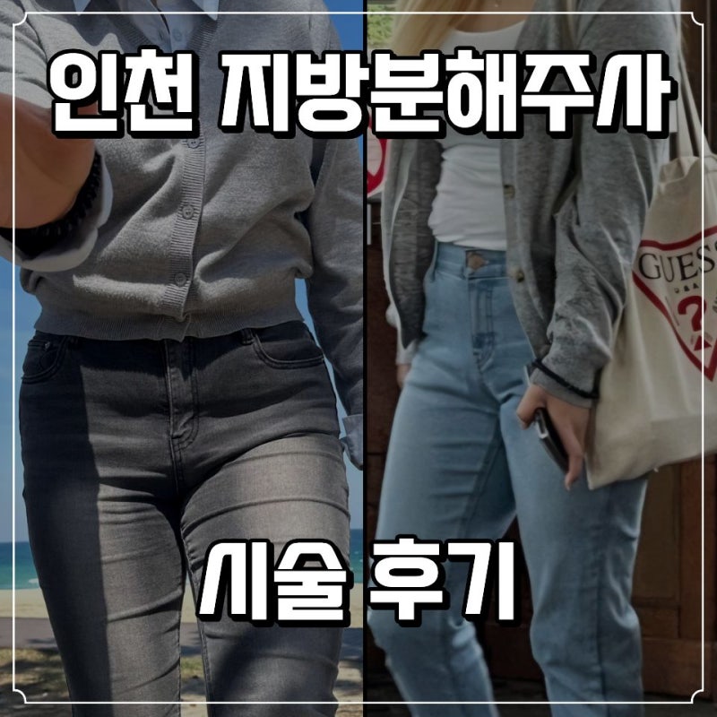인천 허벅지살 빼는 법 인천지방분해주사 비수술 체형관리 내돈내산 후기