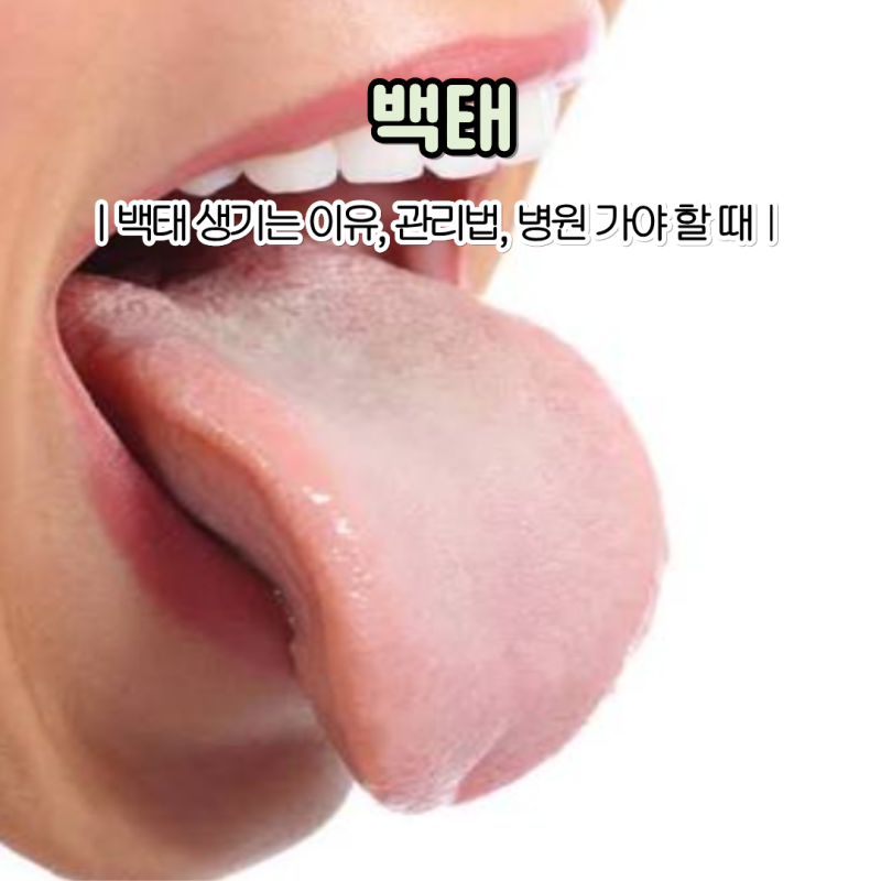혀에 하얀 백태 생기는 이유 백태 제거 방법은?