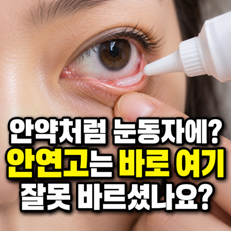 “안약처럼 눈동자에 바로 바르셨나요?” 안연고 사용법에서 헷갈리기 쉬운 ‘이 위치’