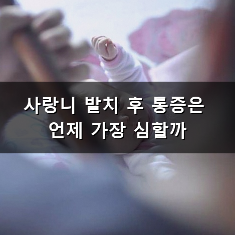 사랑니 발치 후 언제까지 아플까? 기간별 통증 양상과 대처법