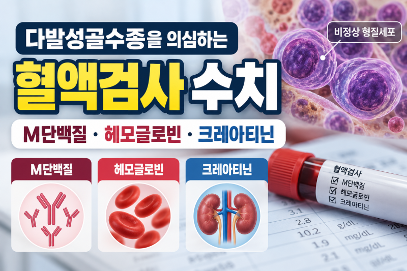 다발성골수종을 의심하는 혈액검사 수치 | M단백·헤모글로빈·크레아티닌