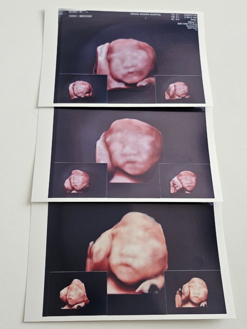 임신기록 | 첫 태동부터 육아휴직까지, 임신 중기 이야기