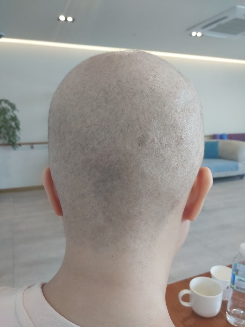 항암을 앞두고 있을 때 무엇이 필요할까?