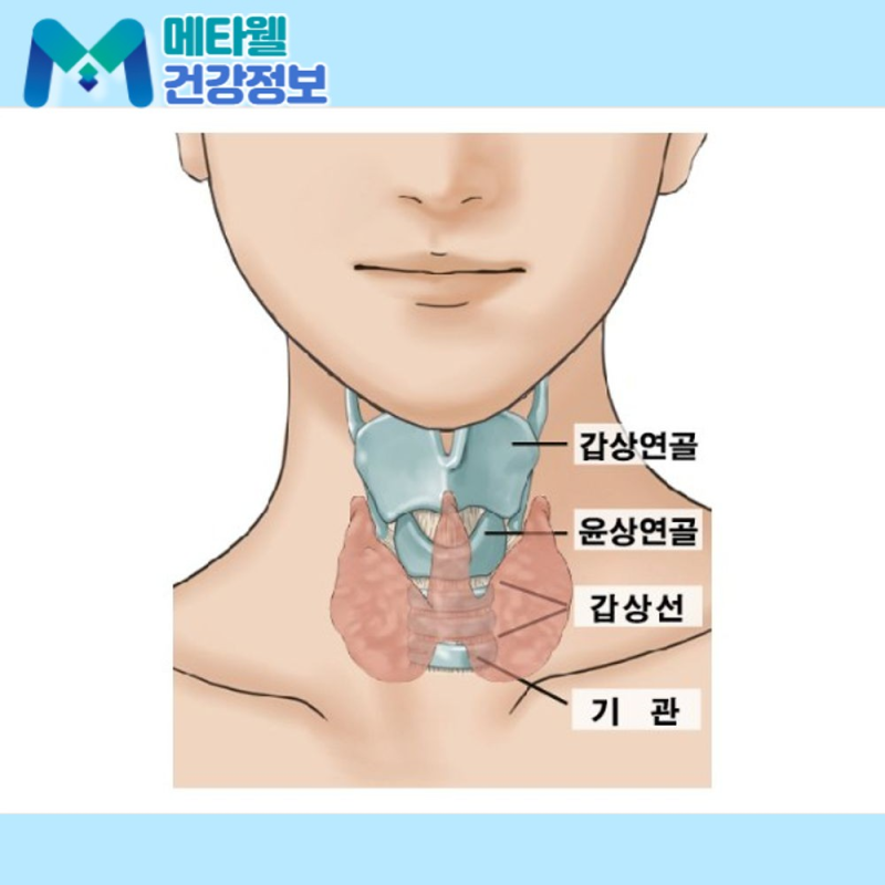 갑상선염 증상, 목이 붓고 아프니 갑상선암일까 걱정하셨죠? 아프고 열이 나면 오히려 염증 ....