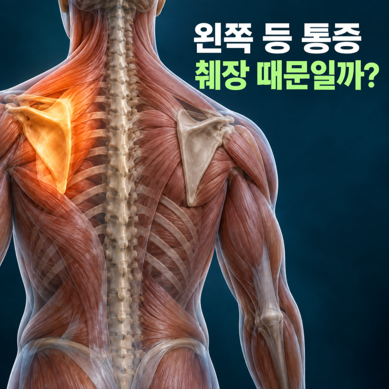 왼쪽 등 통증, 췌장 때문일까?