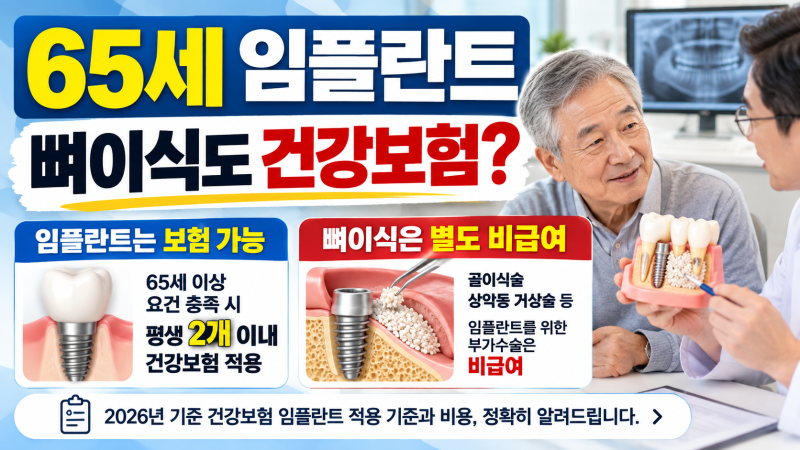 65세 임플란트, 뼈이식 비용도 건강보험이 될까?