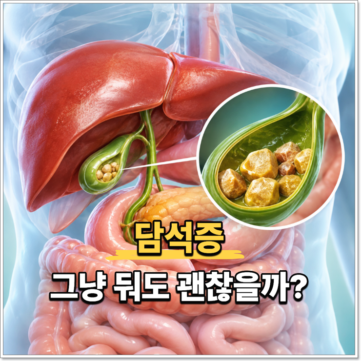 담석증 그냥 넘겨도 될까? 담낭염 증상과 치료 방법까지 알아보기