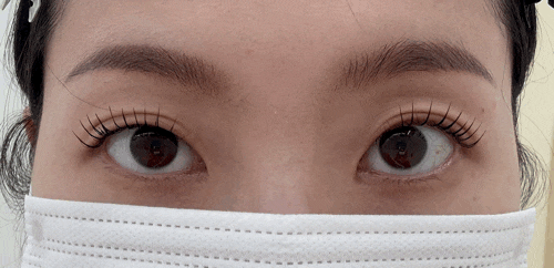 [찐 내돈내산] 속눈썹 생장제 래쉬애딕트 효과 테스트하려고 속눈썹 자른 원장의 짝짝이 속....
