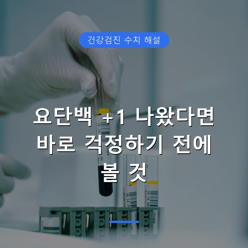 요단백 +1 나왔을 때 재검 필요할까, 일시적 단백뇨 구별법