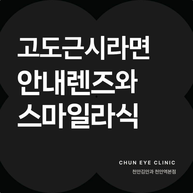 천안 안내렌즈삽입술과 스마일라식, 고도근시에서 달라지는 점