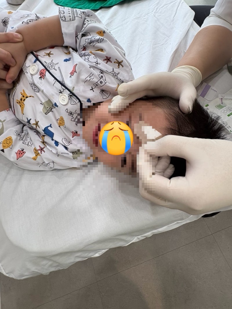 부천에서 인천 검단 프로퍼성형외과로, 28개월 아기 얼굴 찢어짐 국소마취 봉합 후기