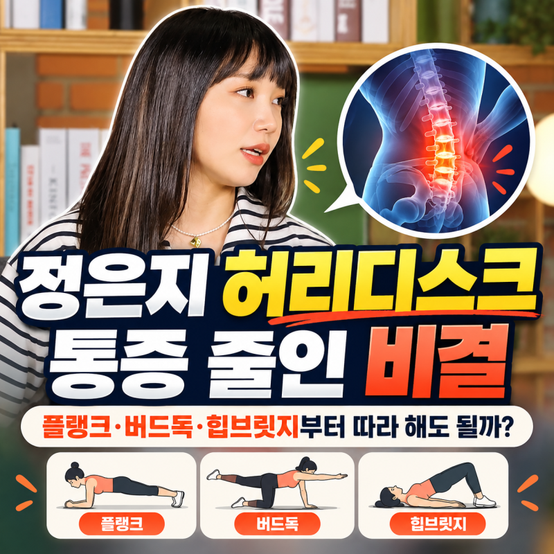 정은지 허리디스크 통증 줄인 비결, 플랭크·버드독·힙브릿지부터 따라 해도 될까?