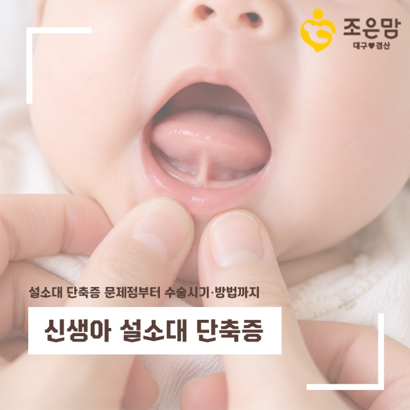 신생아 설소대 짧음 증상은? 설소대 단축증 문제점부터 수술시기·방법까지