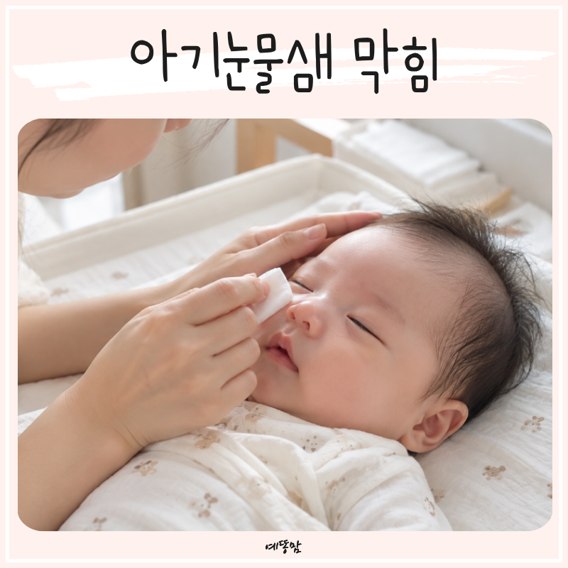 아기눈물샘 막힘 원인부터 신생아눈꼽 관리까지 알아보기