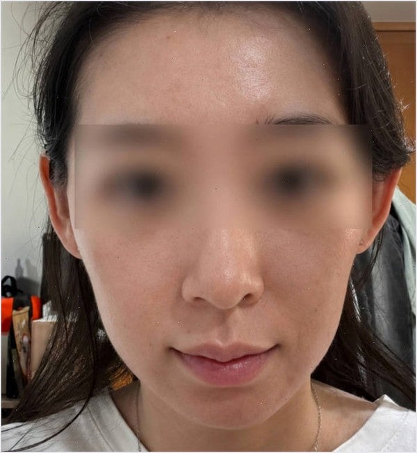 한미 유리아크림 200 두 달 써봤던 분들 궁금하셨죠?