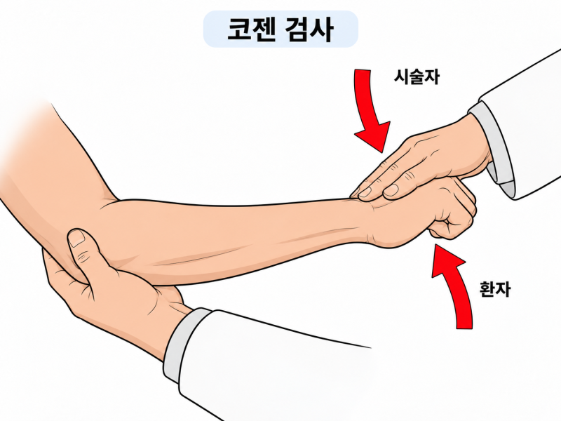 [365마디척한의원추의원] 테니스 엘보우, 단순한 팔꿈치 염증이 아닙니다!