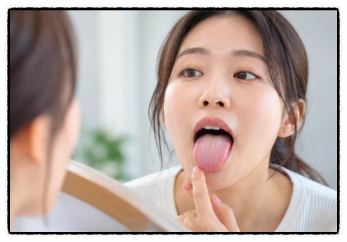 혀 백태 원인, 혀가 하얗게 보이는 이유와 없애는 방법