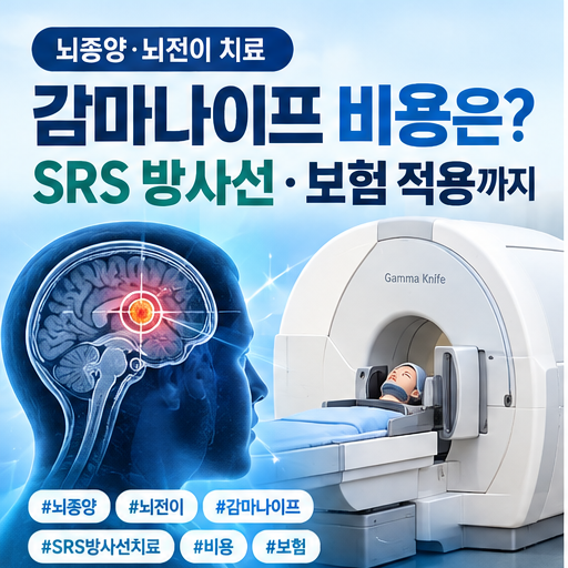 「감마나이프 비용 얼마일까? 뇌전이 치료 SRS 방사선·보험 적용까지」