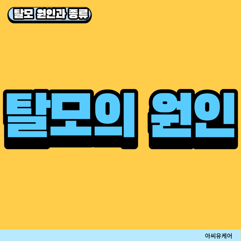 탈모 원인과 종류 정리, 치료는 언제 시작해야 할까