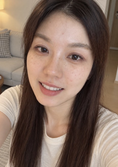 편도결석 원인 자꾸 생기는 이유 따로 있어요