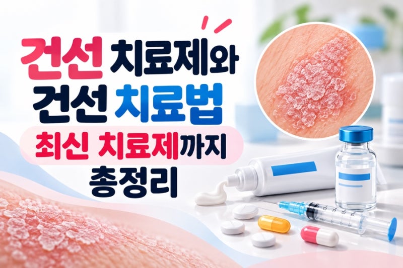 건선 치료제와 건선 치료법 최신 치료제까지 총정리