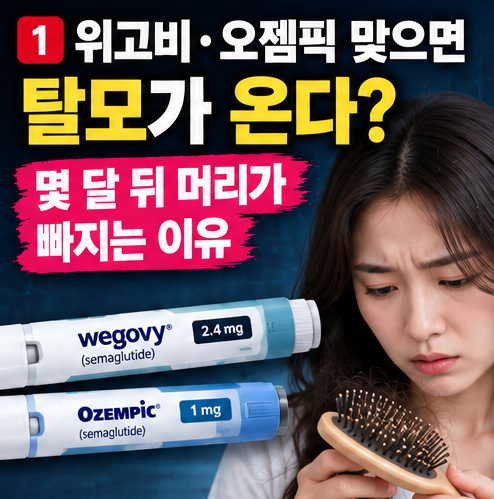 위고비 오젬픽 다이어트 주사 맞으면 탈모 온다? 몇 달 뒤 머리가 빠지는 이유