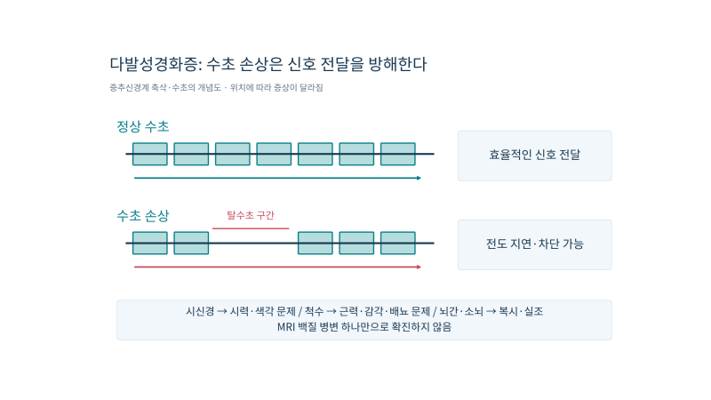 의학이론 제5편 척추·두부·신경계ㅣ제14장 뇌졸중·발작 및 주요 신경계 질환