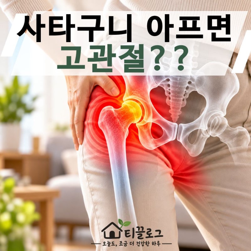 걸을 때 사타구니가 계속 아프다면? 고관절이 보내는 신호일 수도