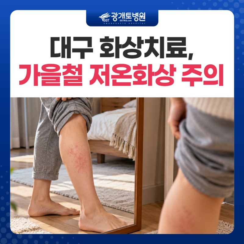 대구화상치료, 날씨가 쌀쌀해지면 저온화상을 조심해야 하는 이유