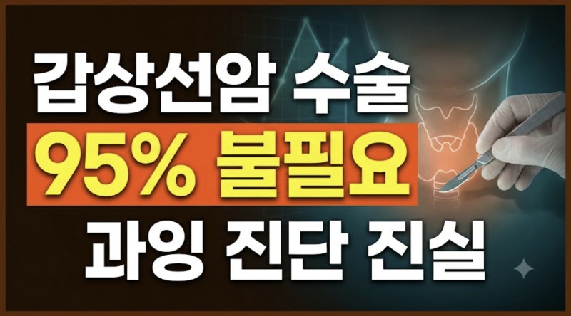 갑상선암 수술 95%는 불필요했다? 암 환자 급증 이면의 과잉 진단과 생존율의 진실