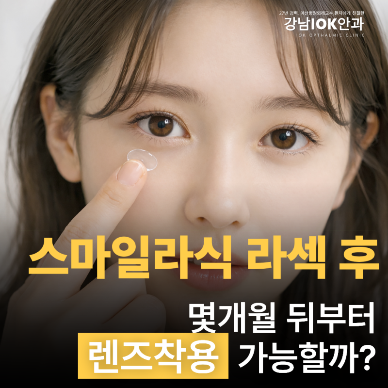 스마일라식 라섹 후 몇개월 뒤부터 렌즈착용 가능할까?