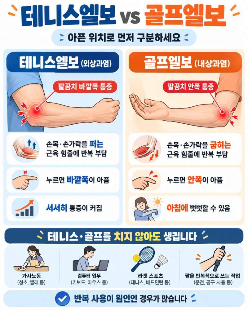 엘보우 통증, 팔꿈치 바깥쪽이면 테니스엘보 안쪽이면 골프엘보입니다