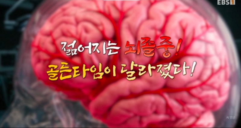 "젊어서 혈압 신경 안 썼는데…" 박익성 교수가 짚은 젊은 뇌졸중, 평소 챙겨야 할 "이 숫자"