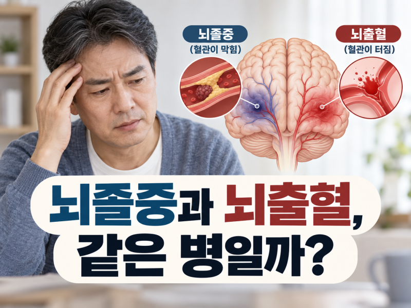 뇌졸중과 뇌출혈은 다른 병일까? 뇌경색까지 헷갈리는 차이 한 번에 정리