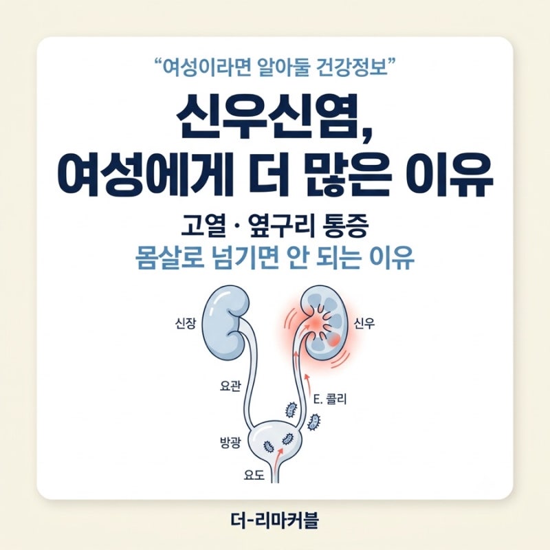 신우신염 증상, 여성에게 더 많은 이유｜고열·옆구리 통증 방치하면 위험한 이유