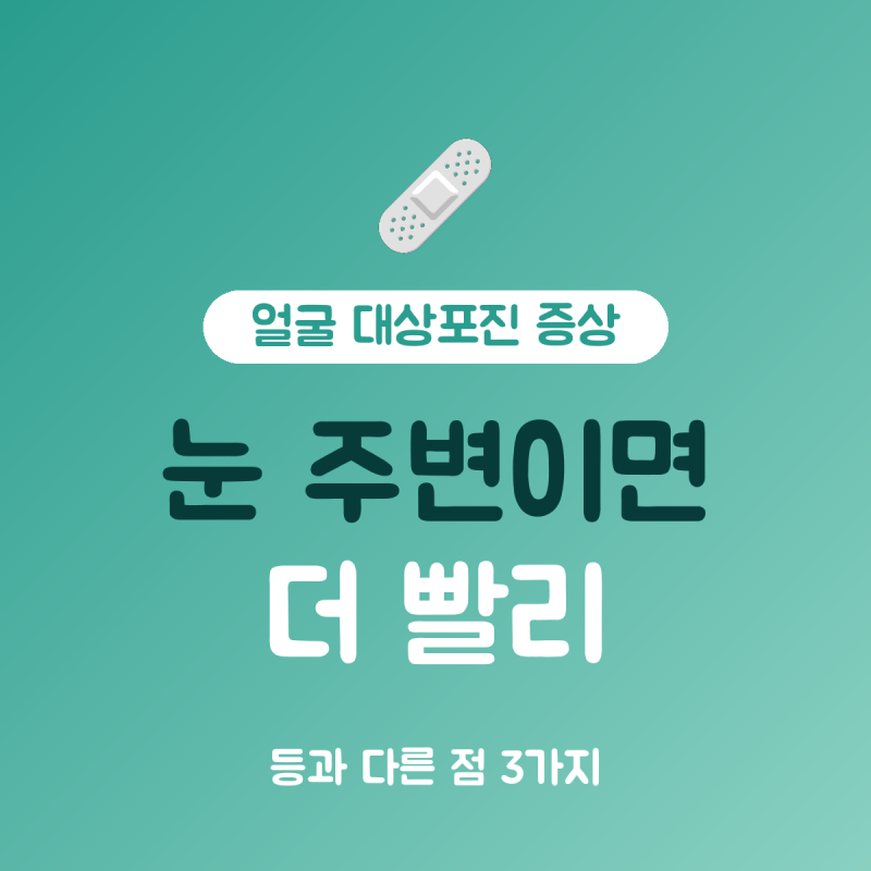 얼굴 대상포진 증상 vs 등 대상포진 증상 차이 3가지, 72시간 내 진료