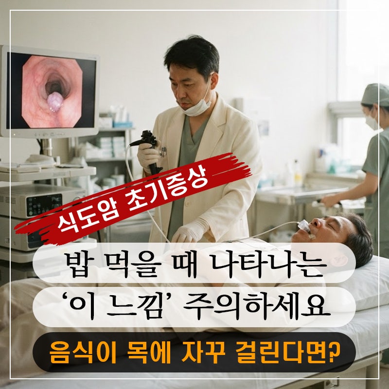 식도암 초기증상, 밥 먹을 때 나타나는 ‘이 느낌’ 주의하세요