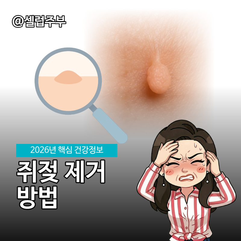 쥐젖제거, 허벅지에 쥐젖 생겨서 피부과에 갔어요