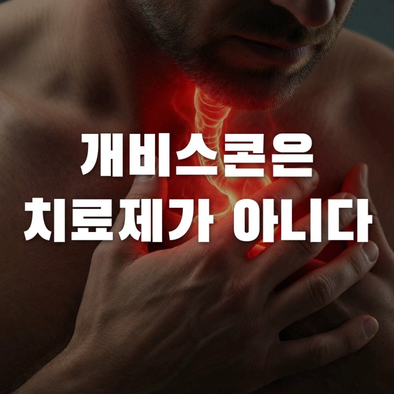 개비스콘은 치료제가 아니다? 역류성식도염 증상 완화의 진실