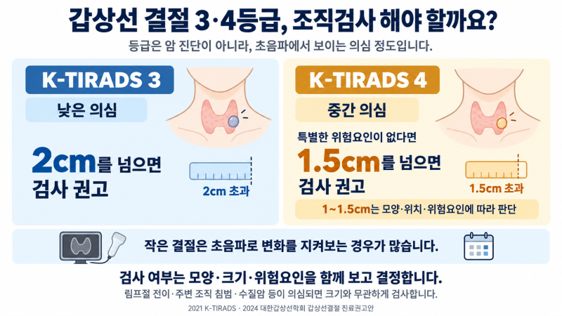 검진 초음파에 '갑상선 결절 K-TIRADS 4'가 나왔습니다