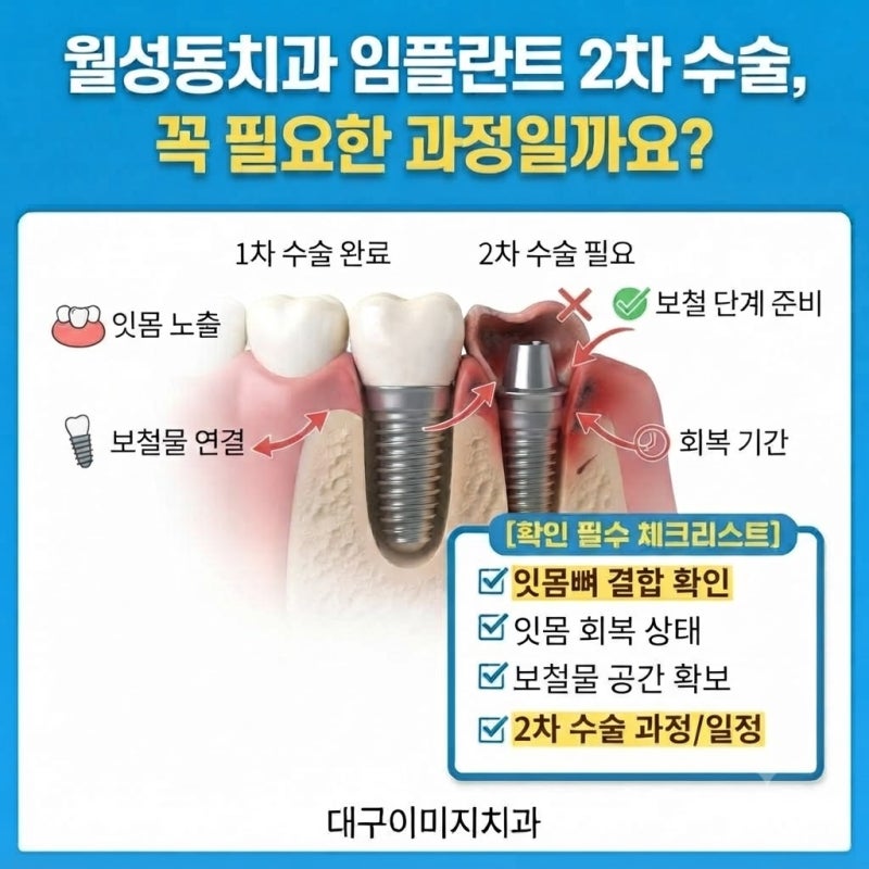 월성동치과 임플란트 2차 수술, 꼭 필요한 과정일까요?