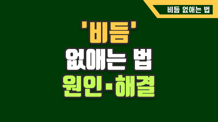 비듬 왜 나만 생기지? 머리도 매일 감는데... 무엇이 잘 못 된걸까? (비듬 없애는 법)