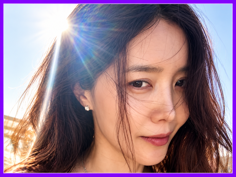 「남자친구 만나려고 붕대까지 감았습니다」 채정안, 무슨 일이?
